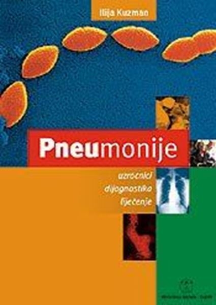 Pneumonije : uzročnici, dijagnostika, liječenje