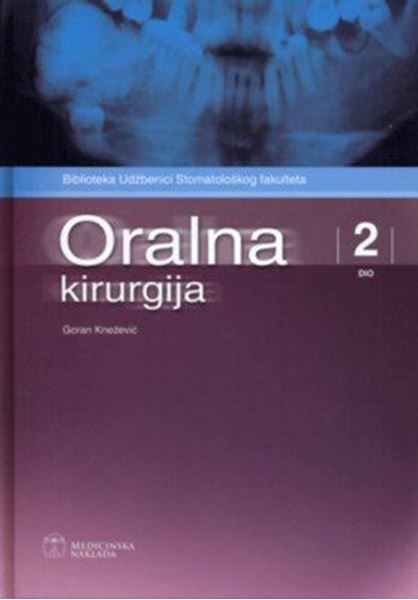 Oralna kirurgija (2.dio)