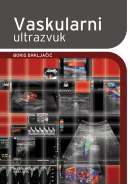 Vaskularni ultrazvuk 