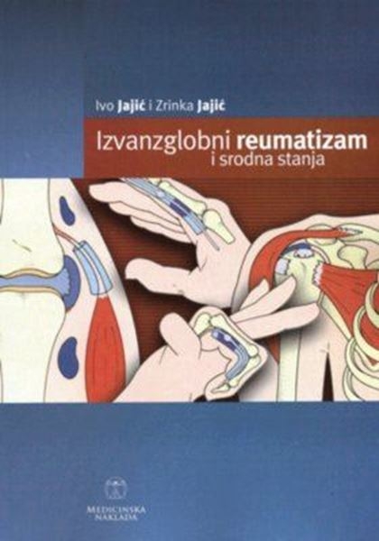 Izvanzglobni reumatizam i srodna stanja : priručnik za reumatologe, fizijatre, interniste, ortopede, medicinare rada i liječnike opće medicine