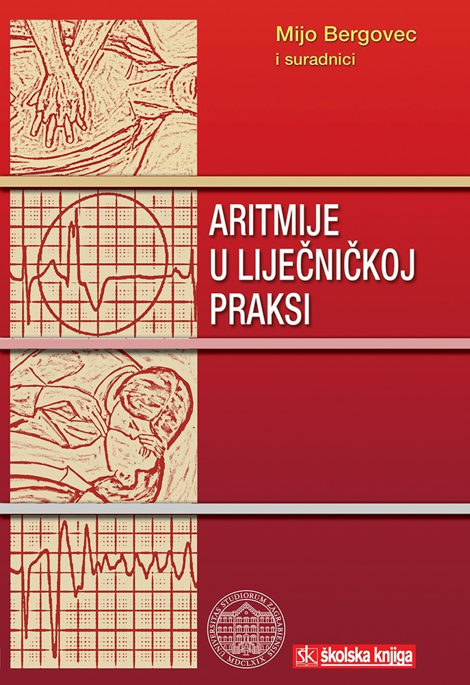 Aritmije u liječničkoj praksi