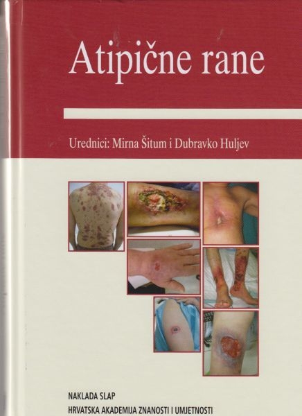 Atipične rane : znanstvena monografija