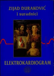 Elektrokardiogram : za studente i liječnike