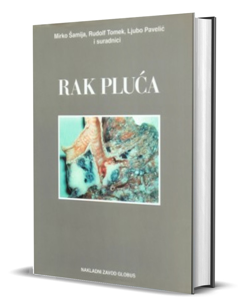 Rak pluća