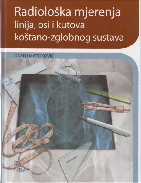 Radiološka mjerenja linija, osi i kutova koštano-zglobnog sustava