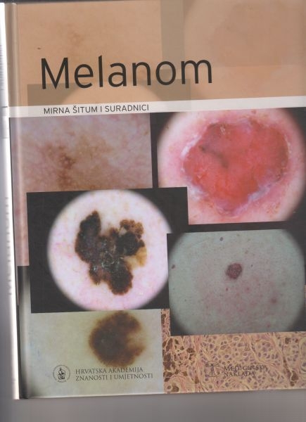 Melanom : udžbenik i atlas