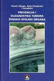 Prevencija i dijagnostika tumora ženskih spolnih organa