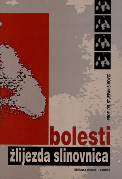 Bolesti žlijezda slinovnica