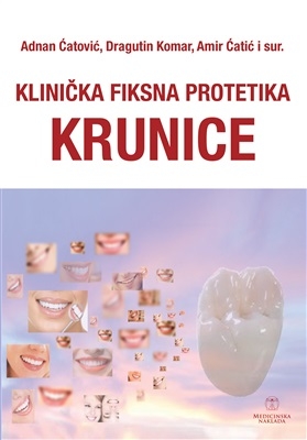 Klinička fiksna protetika - Krunice