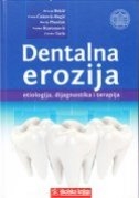 Dentalna erozija : etiologija, dijagnostika i terapija