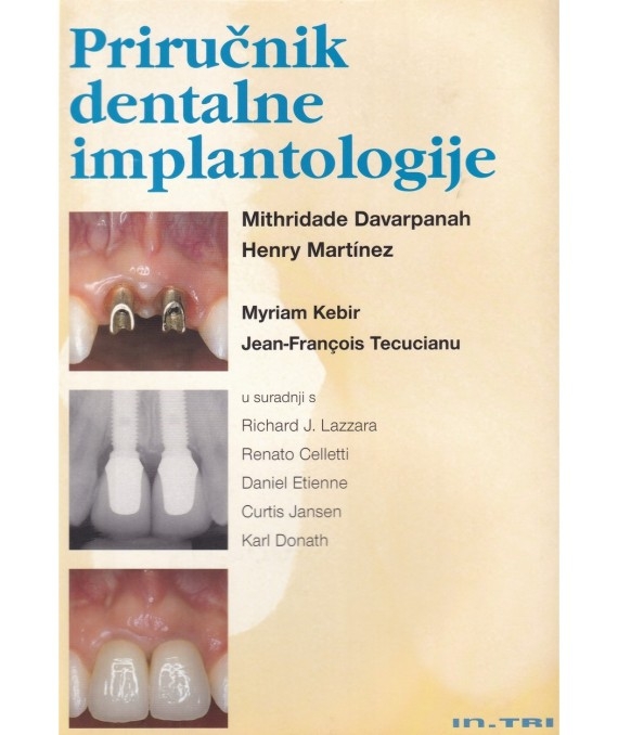 Priručnik dentalne implantologije