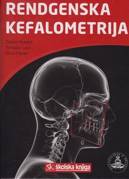 Rendgenska kefalometrija