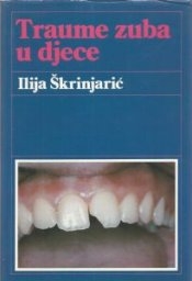 Traume zuba u djece 