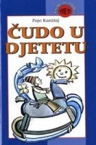 Čudo u djetetu